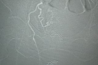 NÚT TẮC ĐỘNG MẠCH TỬ CUNG CẦM MÁU TỨC THÌ CỨU BỆNH NHÂN UNG THƯ ÂM ĐẠO CHẢY MÁU Ồ ẠT